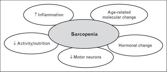 Muscle LOSS leads to DISEASE (part 1)