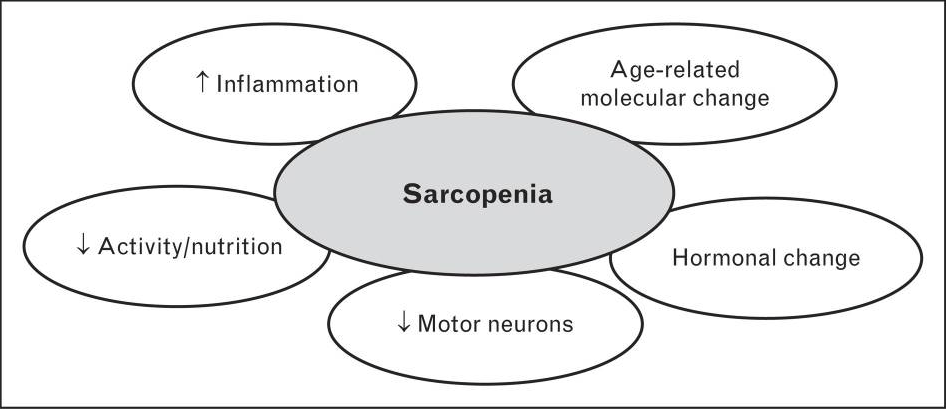 sarco chart